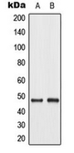 Anti-c-Jun (phospho Thr93) antibody used in Western Blot (WB). GTX32331