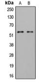 Anti-LYN (phospho Tyr508) antibody used in Western Blot (WB). GTX32334