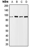 Anti-NBS1 (phospho Ser343) antibody used in Western Blot (WB). GTX32339