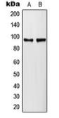Anti-PLA2G4A (phospho Ser505) antibody used in Western Blot (WB). GTX32342