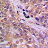 Anti-AMPK alpha 1 (phospho Ser496) antibody used in IHC (Paraffin sections) (IHC-P). GTX32345