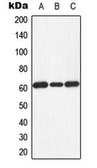 Anti-PKR (phospho Thr451) antibody used in Western Blot (WB). GTX32348