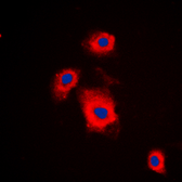 Anti-p70 S6K (phospho Ser447) antibody used in Immunocytochemistry/ Immunofluorescence (ICC/IF). GTX32354