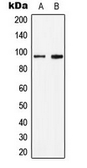 Anti-STAT6 (phospho Tyr641) antibody used in Western Blot (WB). GTX32357