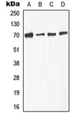 Anti-TGF beta Receptor 2 (phospho Ser225) antibody used in Western Blot (WB). GTX32359