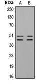 Anti-VASP (phospho Ser157) antibody used in Western Blot (WB). GTX32362