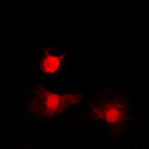 Anti-HDAC8 (phospho Ser39) antibody used in Immunocytochemistry/ Immunofluorescence (ICC/IF). GTX32364