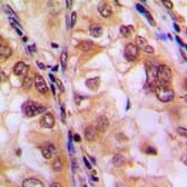 Anti-HDAC8 (phospho Ser39) antibody used in IHC (Paraffin sections) (IHC-P). GTX32364