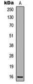 Anti-CDKN2A / p16INK4a (phospho Ser326) antibody used in Western Blot (WB). GTX32378