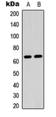Anti-CRMP2 (phospho Ser522) antibody used in Western Blot (WB). GTX32383