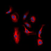 Anti-Her3 / ErbB3 (phospho Tyr1328) antibody used in Immunocytochemistry/ Immunofluorescence (ICC/IF). GTX32388