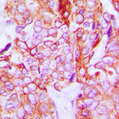 Anti-Her3 / ErbB3 (phospho Tyr1328) antibody used in IHC (Paraffin sections) (IHC-P). GTX32388