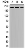 Anti-IRS1 (phospho Ser636) antibody used in Western Blot (WB). GTX32400