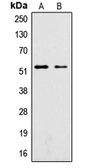 Anti-SGK1 (phospho Ser422) antibody used in Western Blot (WB). GTX32413