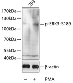 Anti-ERK3 (phospho Ser189) antibody used in Western Blot (WB). GTX32415