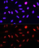 Anti-Histone H3T11ph (phospho Thr11) antibody used in Immunocytochemistry/ Immunofluorescence (ICC/IF). GTX32417