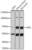 Anti-NF-L antibody used in Western Blot (WB). GTX32419
