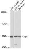 Anti-ABAT antibody used in Western Blot (WB). GTX32420