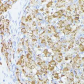Anti-ACAT2 antibody used in IHC (Paraffin sections) (IHC-P). GTX32422