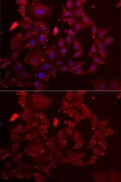 Anti-Adenylosuccinate synthase antibody used in Immunocytochemistry/ Immunofluorescence (ICC/IF). GTX32424