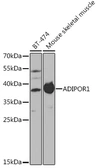 Anti-Adiponectin Receptor 1 antibody used in Western Blot (WB). GTX32425