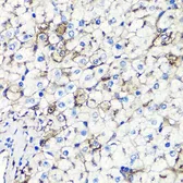 Anti-Albumin antibody used in IHC (Paraffin sections) (IHC-P). GTX32430