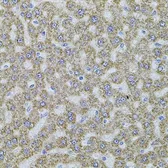 Anti-ALDH1A1 antibody used in IHC (Paraffin sections) (IHC-P). GTX32431