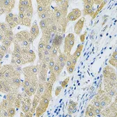 Anti-ALG2 antibody used in IHC (Paraffin sections) (IHC-P). GTX32432