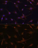 Anti-AMPK beta 2 antibody used in Immunocytochemistry/ Immunofluorescence (ICC/IF). GTX32439