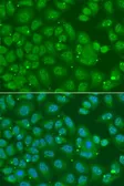 Anti-Annexin A8 like 2 antibody used in Immunocytochemistry/ Immunofluorescence (ICC/IF). GTX32445