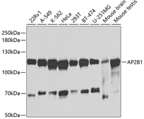 Anti-AP2B1 antibody used in Western Blot (WB). GTX32450