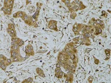Anti-APRIL antibody used in IHC (Paraffin sections) (IHC-P). GTX32453
