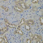 Anti-ARF1 antibody used in IHC (Paraffin sections) (IHC-P). GTX32454