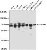 Anti-ATAD3A antibody used in Western Blot (WB). GTX32458