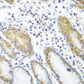 Anti-ATAD3A antibody used in IHC (Paraffin sections) (IHC-P). GTX32458