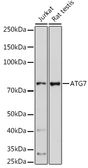 Anti-ATG7 antibody used in Western Blot (WB). GTX32459