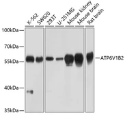 Anti-ATP6V1B2 antibody used in Western Blot (WB). GTX32461