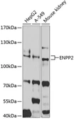Anti-Autotaxin antibody used in Western Blot (WB). GTX32462