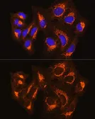 Anti-BAK antibody used in Immunocytochemistry/ Immunofluorescence (ICC/IF). GTX32463