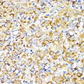 Anti-BMPR1B antibody used in IHC (Paraffin sections) (IHC-P). GTX32474