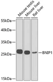 Anti-BNIP1 antibody used in Western Blot (WB). GTX32475