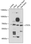 Anti-BORIS antibody used in Western Blot (WB). GTX32476