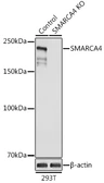 Anti-BRG1 antibody used in Western Blot (WB). GTX32478