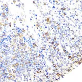 Anti-BTK antibody used in IHC (Paraffin sections) (IHC-P). GTX32479
