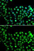 Anti-C16orf80 antibody used in Immunocytochemistry/ Immunofluorescence (ICC/IF). GTX32483