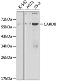 Anti-CARD8 antibody used in Western Blot (WB). GTX32488