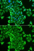 Anti-CARS antibody used in Immunocytochemistry/ Immunofluorescence (ICC/IF). GTX32489