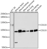 Anti-CD133 antibody used in Western Blot (WB). GTX32496