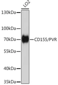 Anti-CD155 antibody used in Western Blot (WB). GTX32498