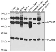 Anti-CD16b antibody used in Western Blot (WB). GTX32499